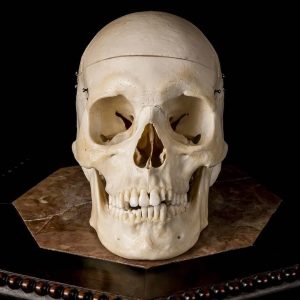 High-grade Medical Specimen Skull